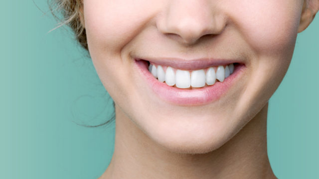 teeth-whitening